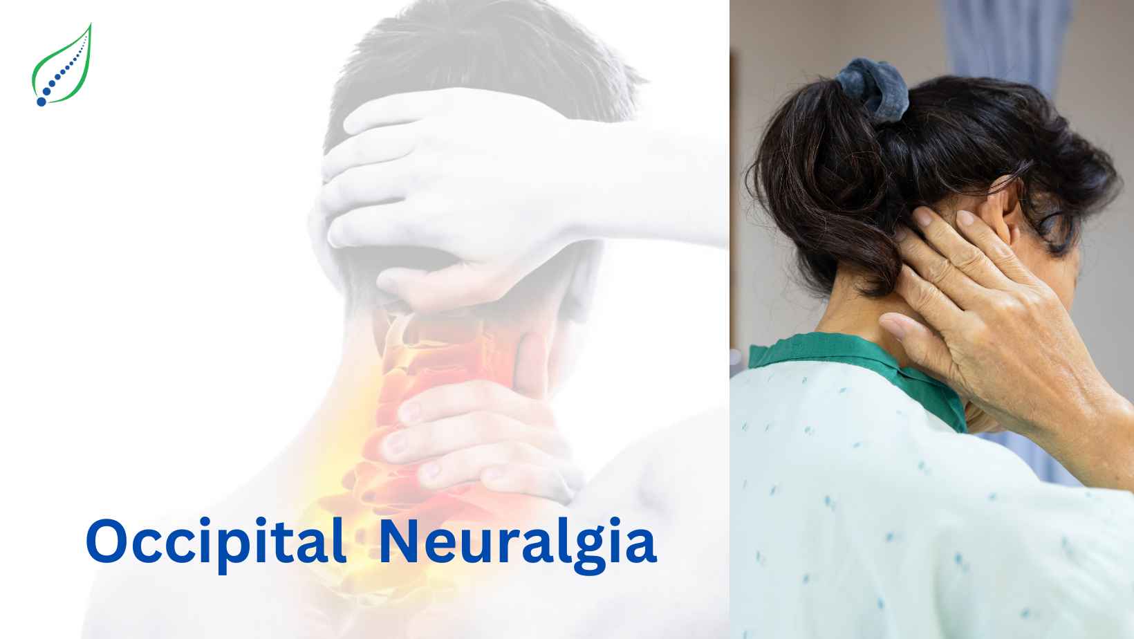 Occipital Neuralgia